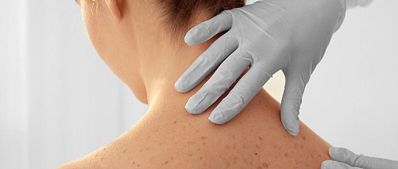 Visite dermatologiche preventive (controllo nei) Settembre 2025