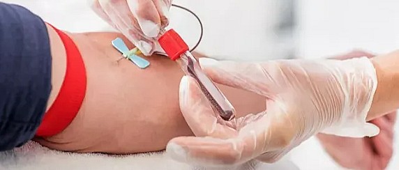 AGGIORNAMENTO DELLE MODALITA' DI FUNZIONAMENTO DEI PUNTI PRELIEVI PERIFERICI