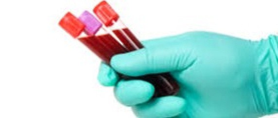 Servizio prelievi ematici anno 2026