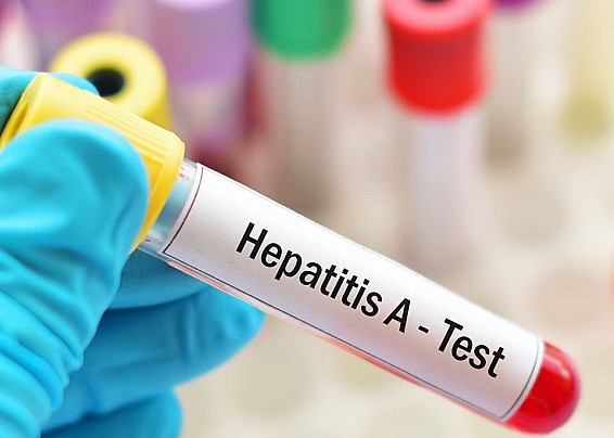 AVVISO: PREVENZIONE EPATITE A (HAV)