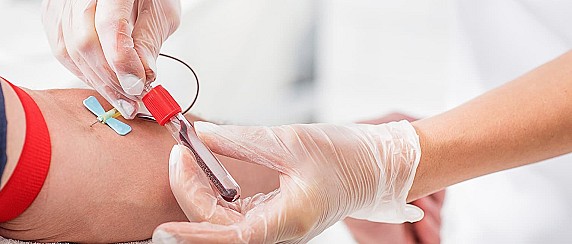 Cambio data prelievi mese di Aprile